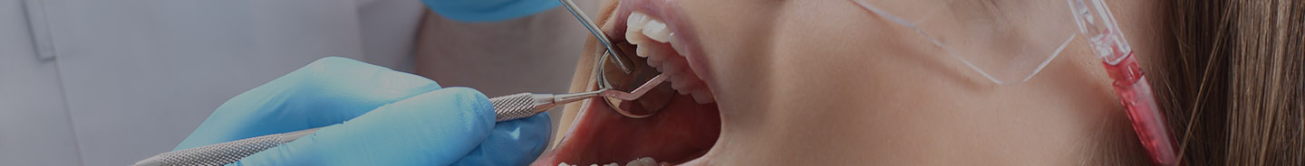 Root Canal