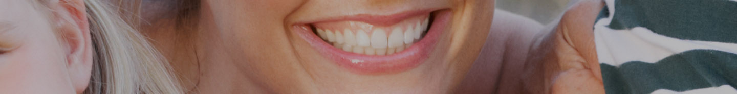 Teeth Whitening